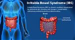 Does Ibs Shorten Your Life?