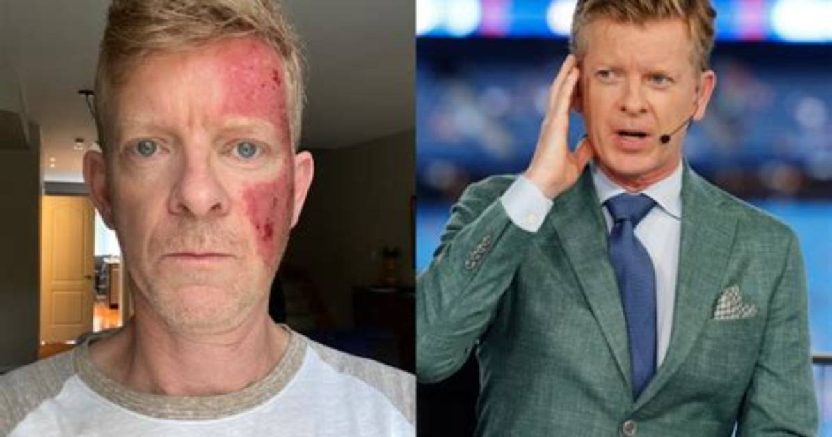 Does Jamie Campbell Have Cancer? ‘Blue Jays’ Commentator’s Hiatus Explained