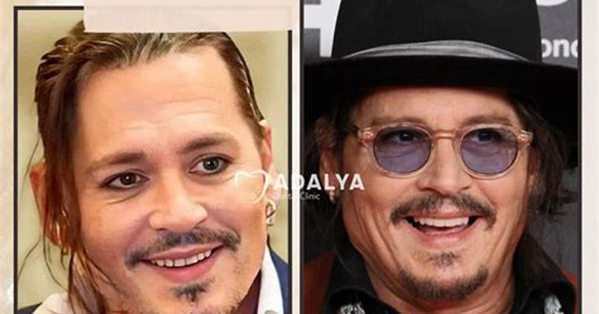 Does Johnny Depp Have Lazy Eye? Blind in One Eye Like a Literal “Pirate”