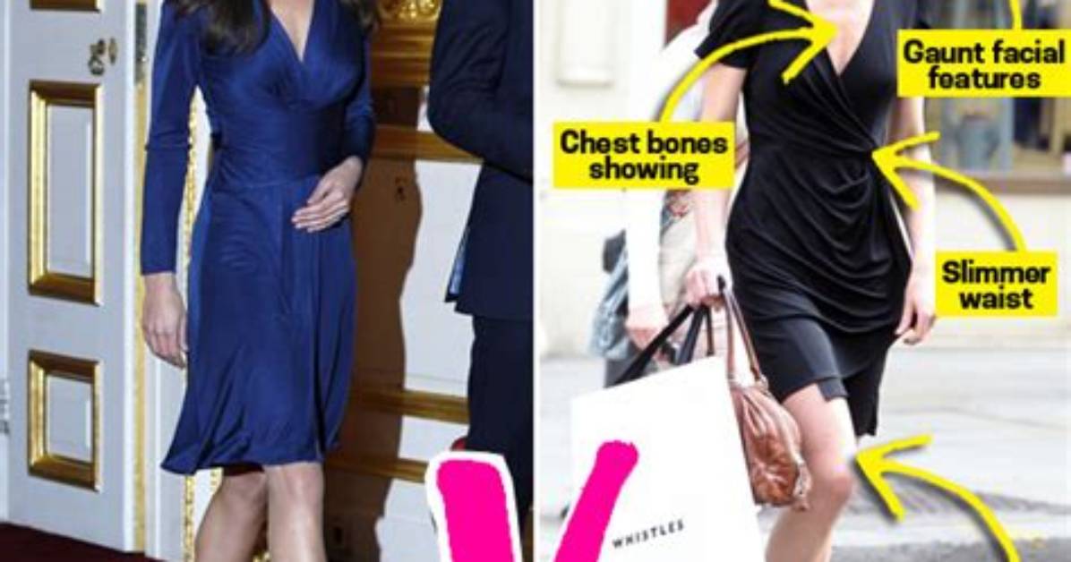Does Kate Middleton Have an Eating Disorder? Diet & Exercise Routine Explained