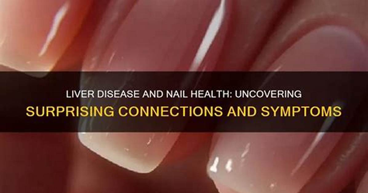 Does Liver Disease Affect Your Fingernails?
