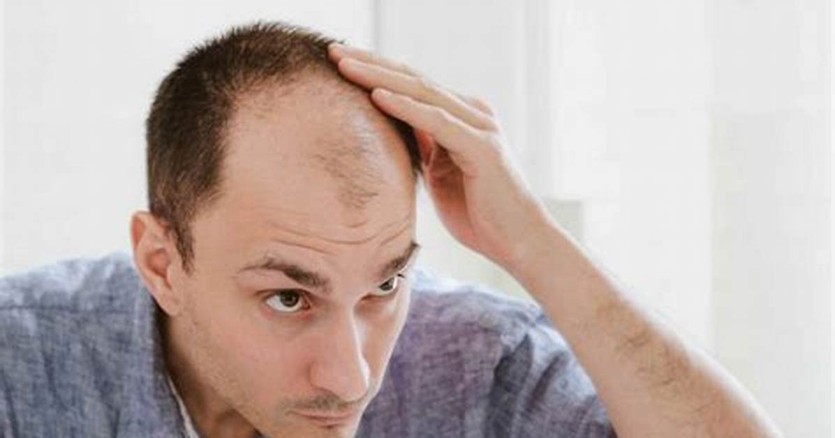 Does Long Hair Make You Look Bald?