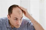 Does Long Hair Make You Look Bald?