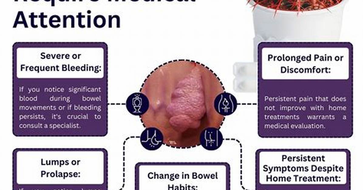 Does Massaging Help Hemorrhoids?