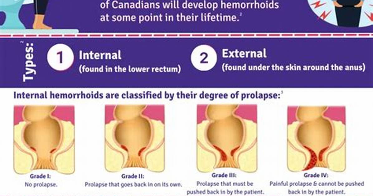 Does Milk Help with Hemorrhoids?