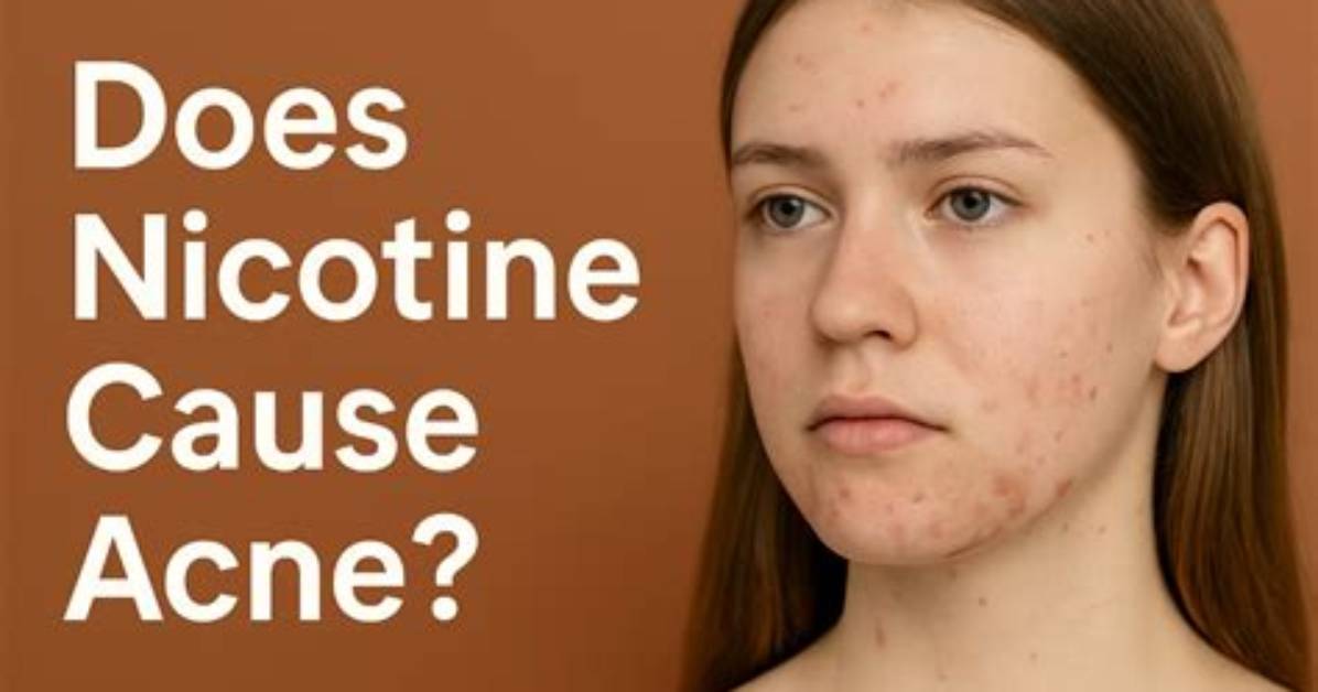 Does Nicotine Cause Acne?