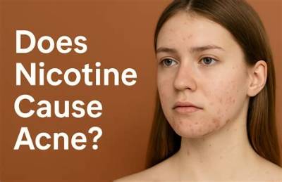 Does Nicotine Cause Acne?