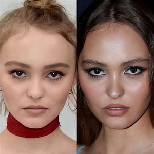 Does Rose Have Plastic Surgery?