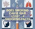 Does Smoking Cause Hair Loss?