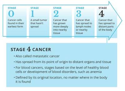 Does Stage 4 Cancer Automatically Qualify for Disability?