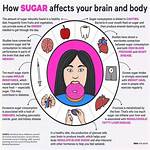 Does Sugar Affect Epilepsy?