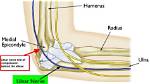 Does Tennis Elbow Affect the Ulnar Nerve?