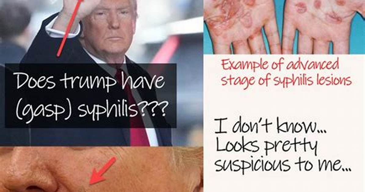Does Trump Have Syphilis? an in-Depth Investigation