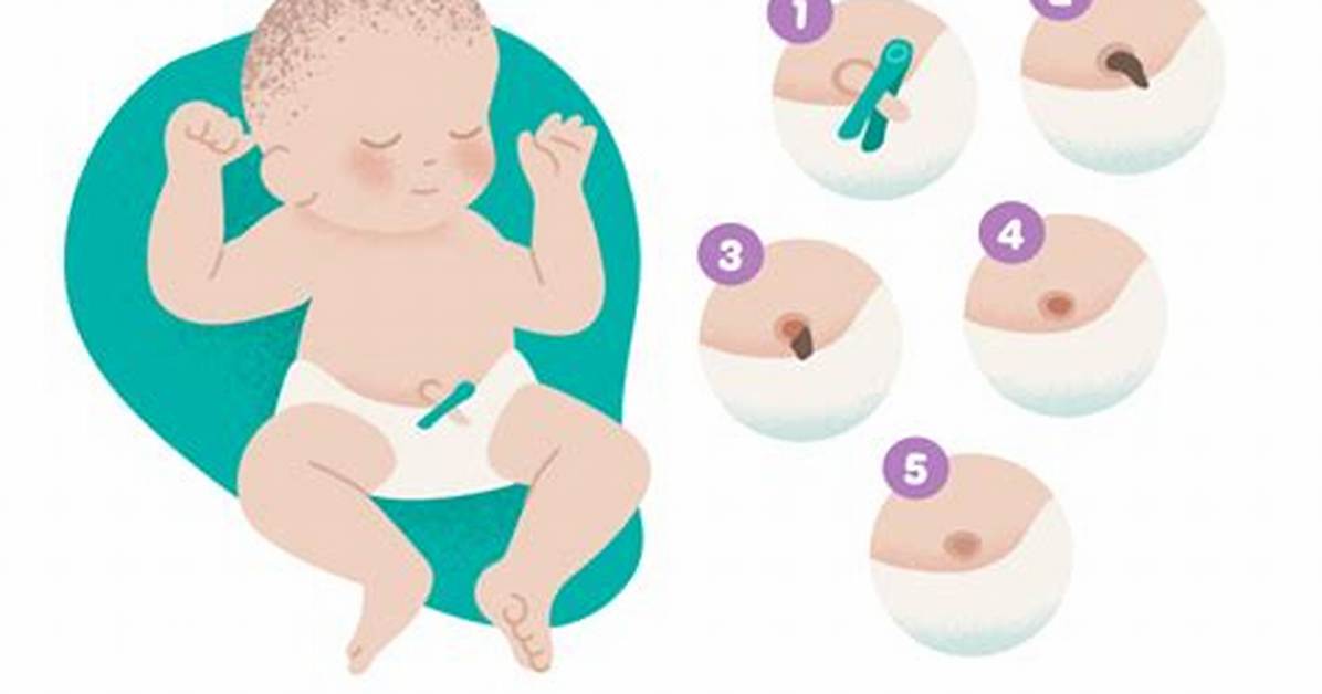 Does Umbilical Cord Bleed When Falling off?