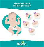 Does Umbilical Cord Bleed When Falling off?