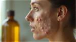 Does Vitamin E Oil Clog Pores?