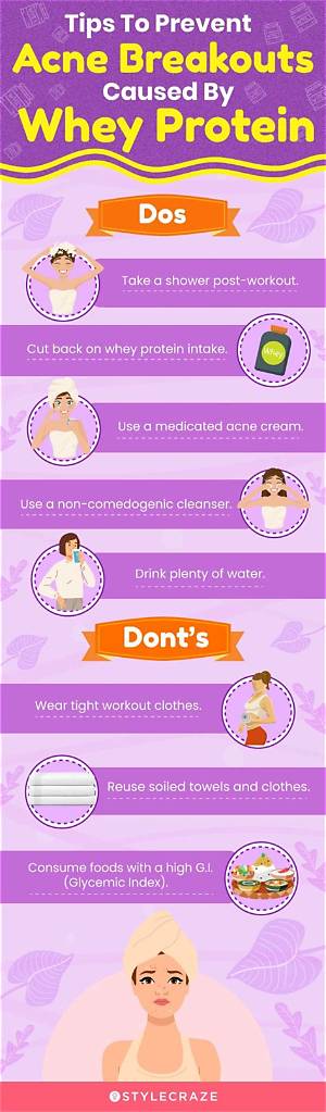 Does Whey Cause Acne?