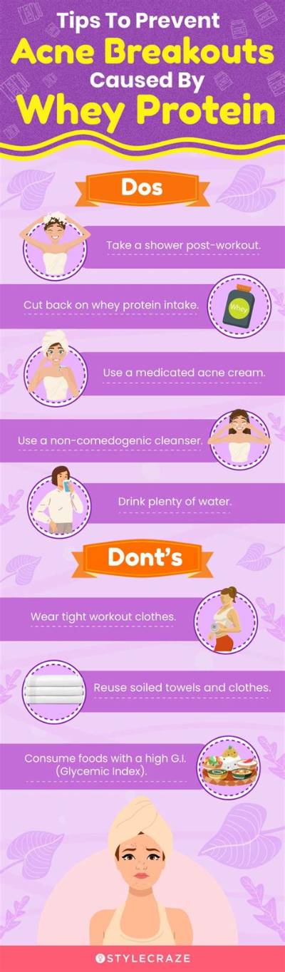 Does Whey Cause Acne?