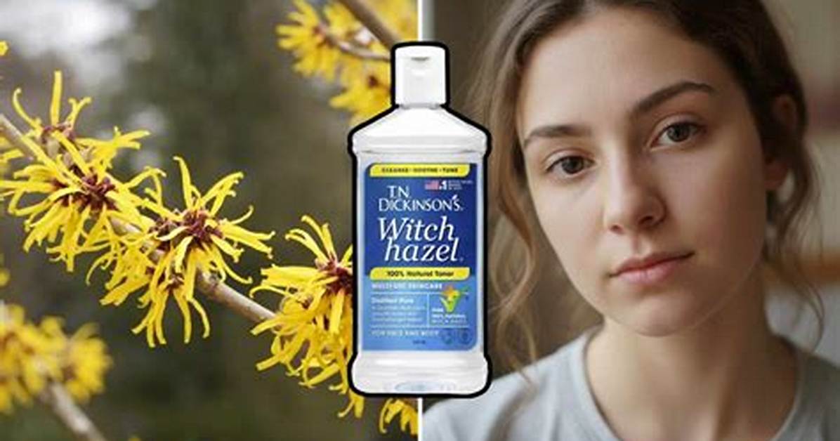 Does Witch Hazel Remove Fake Tan?