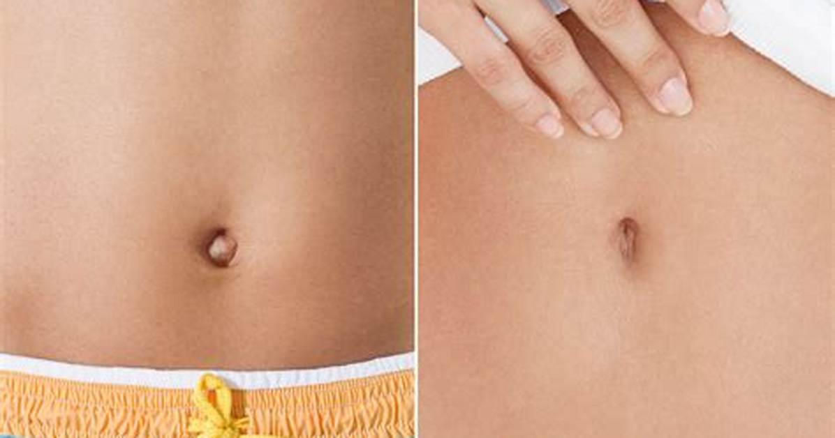Does Your Belly Button Get Deeper When You Gain Weight?