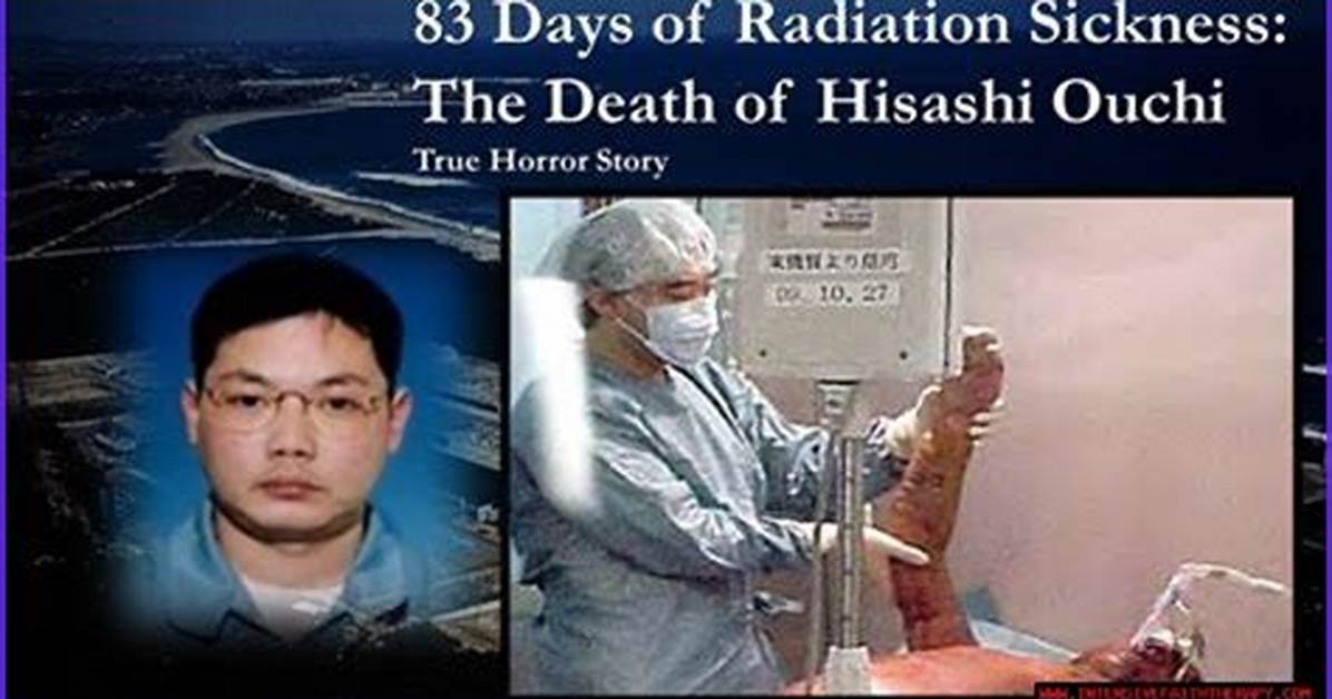 Exclusive Hisashi Ouchi Photos: a Tragic Reminder of the Dangers of Radiation