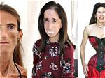 Exploring the Life of the Skinnest Person in the World: a Journey of Resilience and Inspiration
