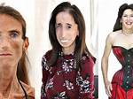 Exploring the Lives of the Skinniest People in the World: Stories, Causes, and Inspiration