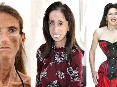 Exploring the Lives of the Skinniest People in the World: Stories, Causes, and Inspiration