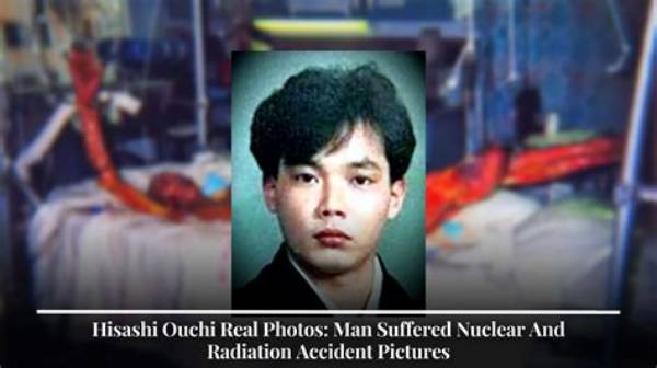 Eye-Opening Images of Hisashi Ouchi's True Story