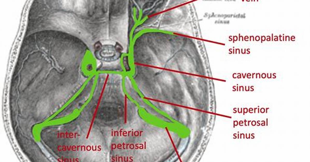 For Superior Petrosal Sinus?
