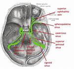For Superior Petrosal Sinus?