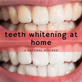 From Whitening Your Teeth to Diy Braces — Are These Tiktok Dental Hacks Dangerous? (Exclusive)