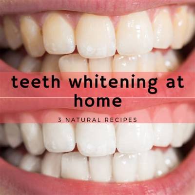 From Whitening Your Teeth to Diy Braces — Are These Tiktok Dental Hacks Dangerous? (Exclusive)
