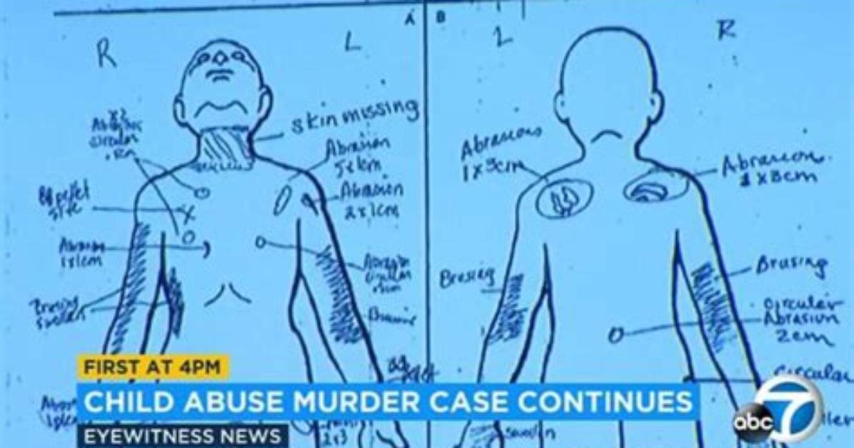 Gabriel Fernandez Crime Scene Photos Death Cause And