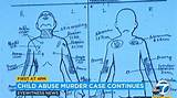 Gabriel Fernandez Crime Scene Photos | Death Cause and Murder Case