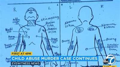 Gabriel Fernandez Crime Scene Photos | Death Cause and Murder Case