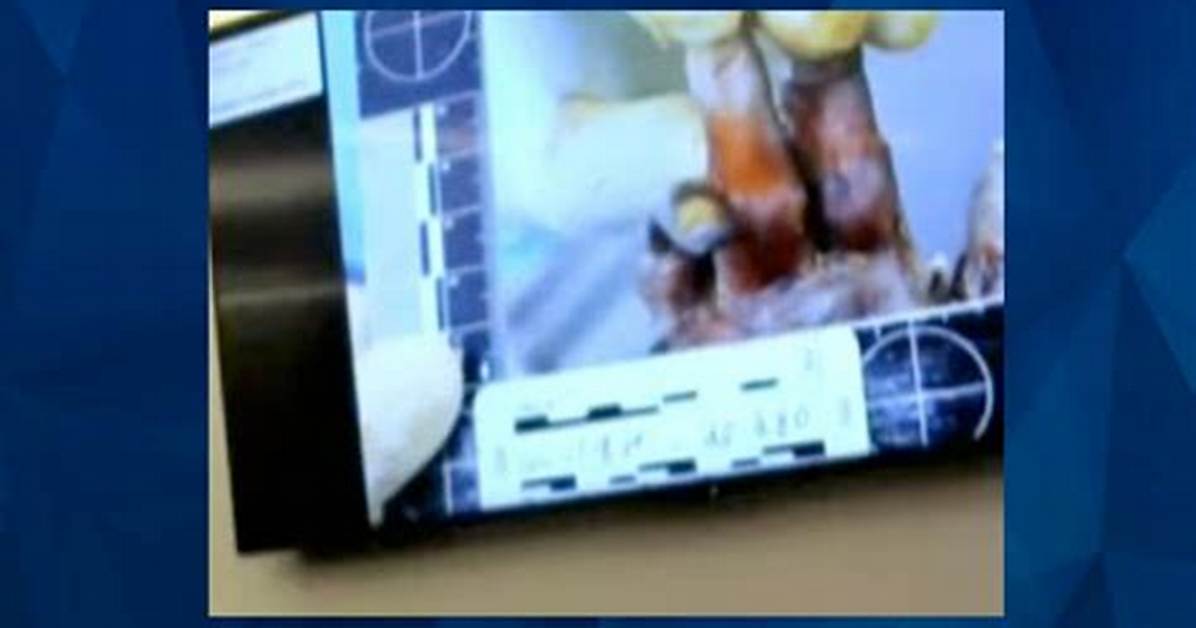 Gannon Stauch Autopsy Photos: Unveiling the Truth Behind the Tragic Story