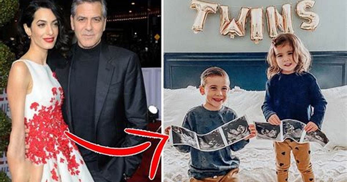 George Clooney's Twins: Raising Awareness for Down Syndrome