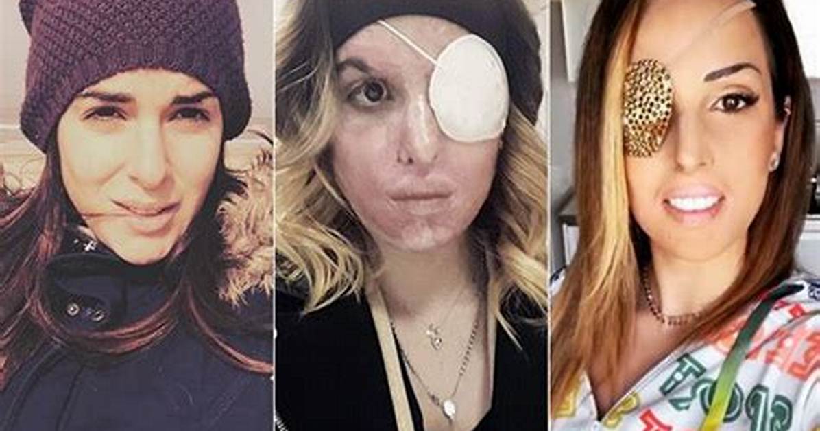 Gessica Notaro Prima Incident Photos: What Happened to Filippo Bologni Moglie? - Sarkariresult