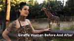 Giraffe Woman Rings Removed
