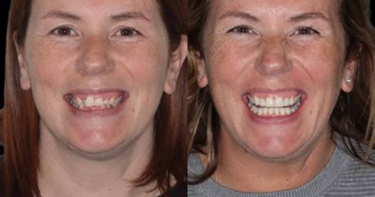 Glasgow Smile: a Revolutionary Approach to Oral Health and Confidence