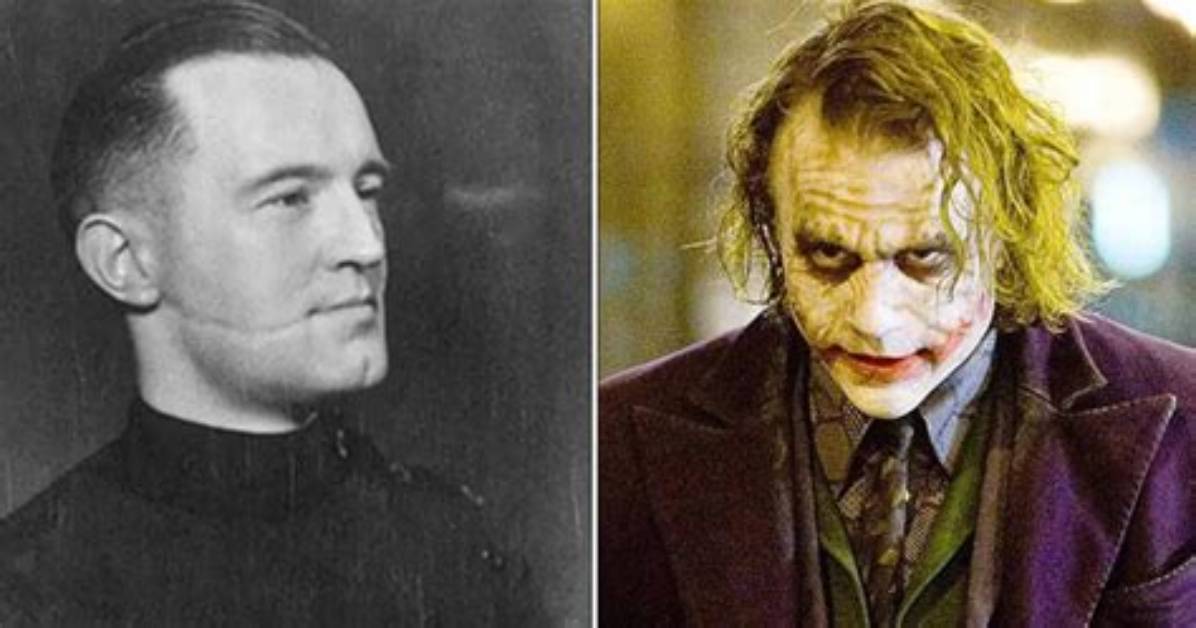 Glasgow Smile Origin: Unveiling the Fascinating History Behind the Iconic Smile
