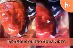 Gore Videos: Agua Quiero - Disturbing Content