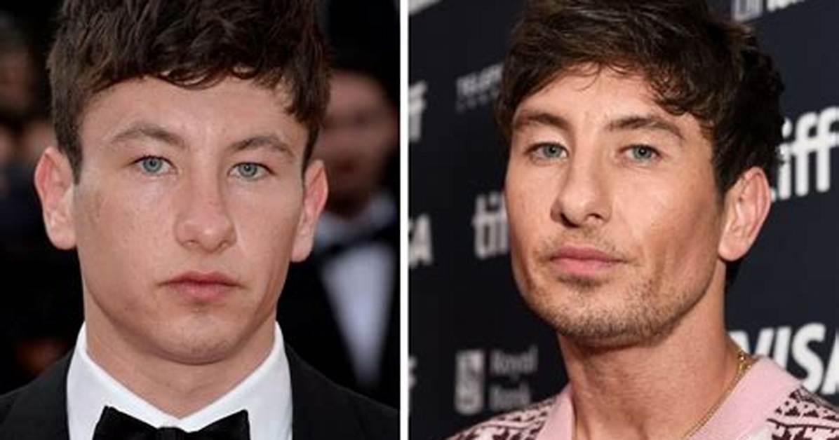 Has Barry Keoghan's Appearance Changed? Plastic Surgery Rumors Explored
