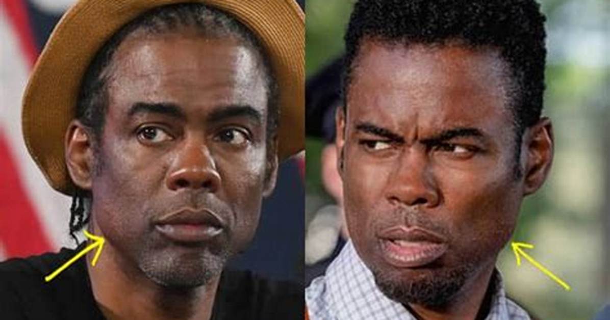 Has Chris Rock Had a Facelift with Botox and a Nose Job Everything You Need To