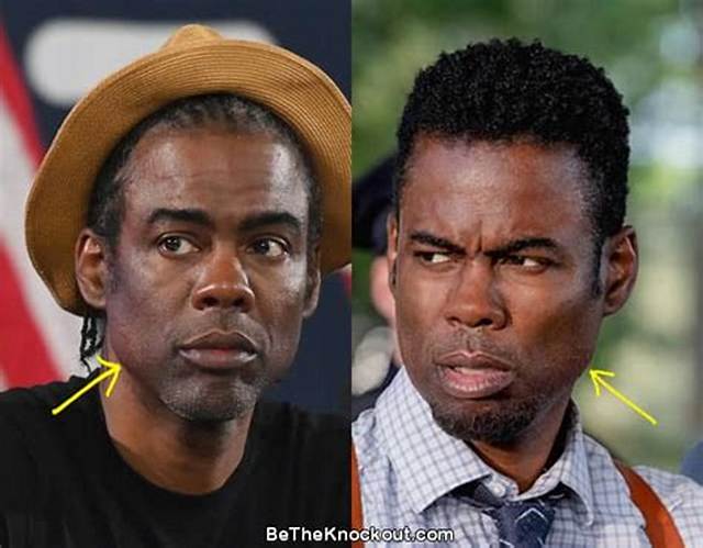 Has Chris Rock Had a Facelift with Botox and a Nose Job? Everything You Need to Know