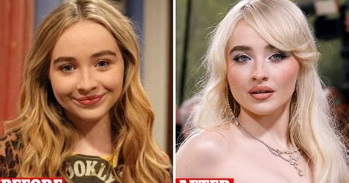Has Sabrina Carpenter Undergone Cosmetic Enhancements?