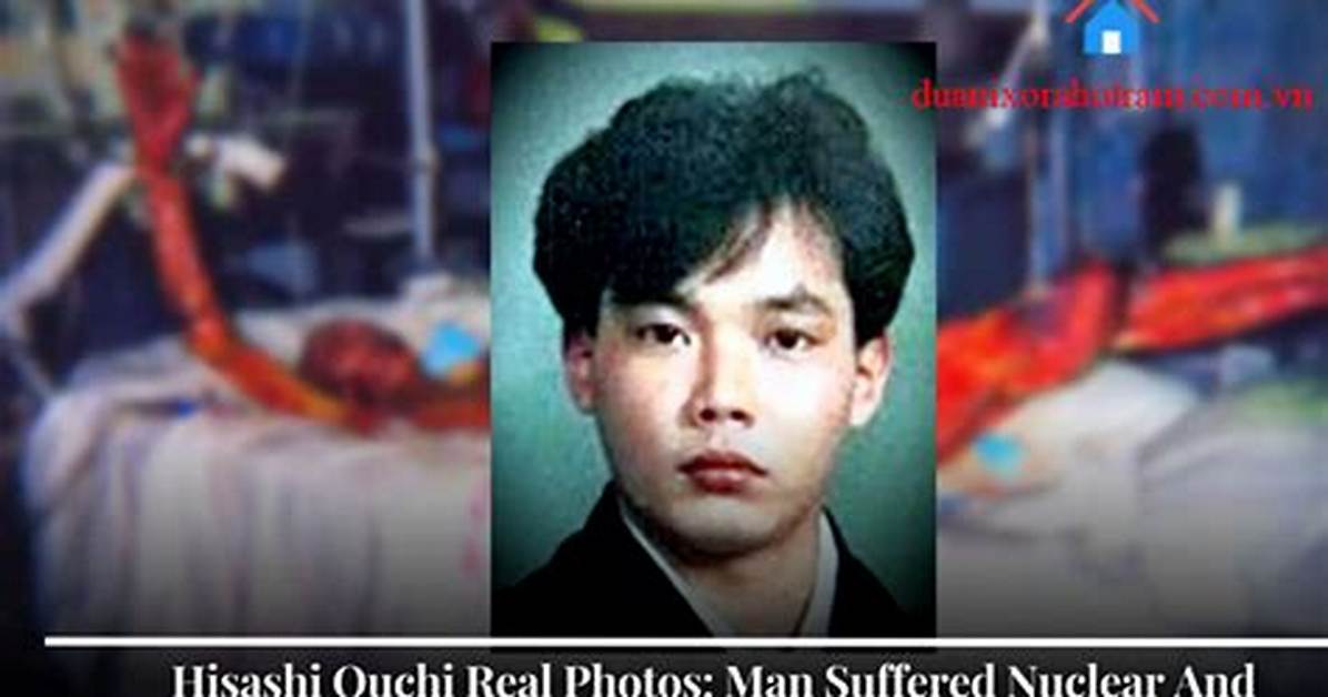 Hisashi Ouchi Death: Was It Real?