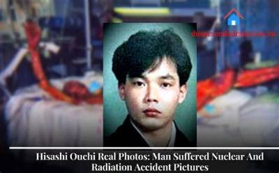 Hisashi Ouchi Death: Was It Real?
