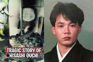Hisashi Ouchi: the Tragic Story Behind the Real Photos from His Hospital Bed